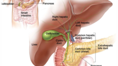 Karaciğer Kanseri Tedavisinde Yeni Umut Mikroküre Tedavisi